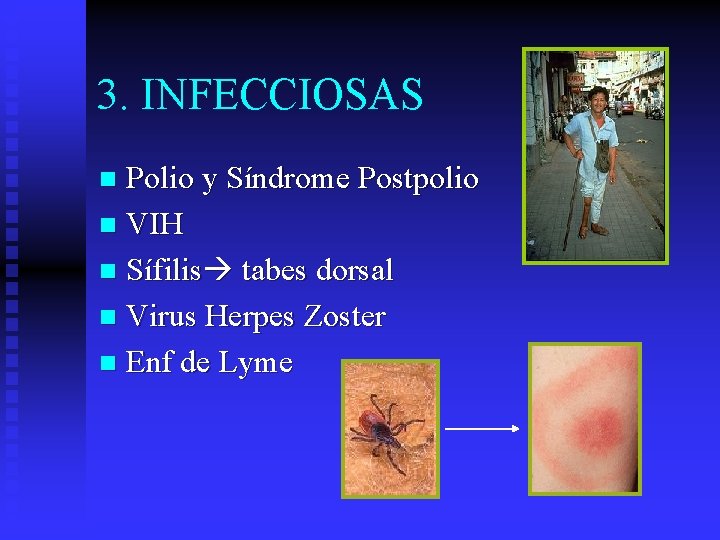 3. INFECCIOSAS Polio y Síndrome Postpolio n VIH n Sífilis tabes dorsal n Virus