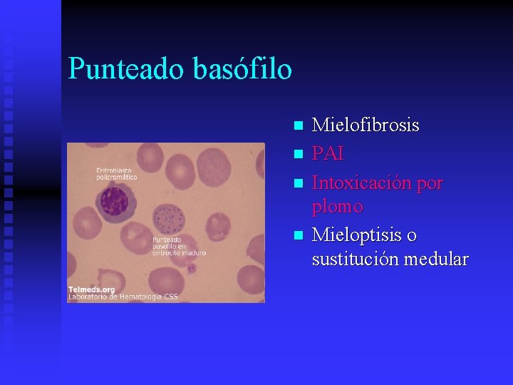 Punteado basófilo n n Mielofibrosis PAI Intoxicación por plomo Mieloptisis o sustitución medular 