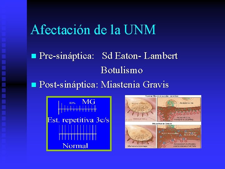 Afectación de la UNM Pre-sináptica: Sd Eaton- Lambert Botulismo n Post-sináptica: Miastenia Gravis n