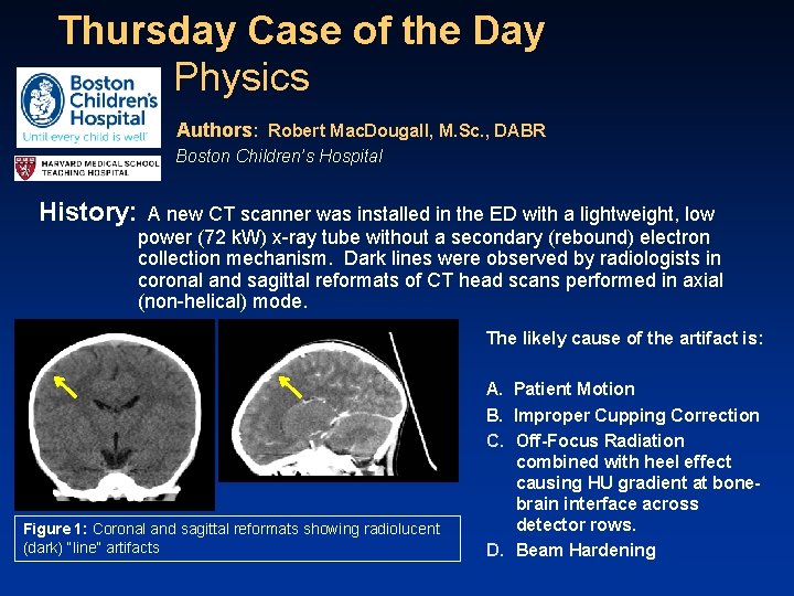 Thursday Case of the Day Physics Authors: Robert Mac. Dougall, M. Sc. , DABR