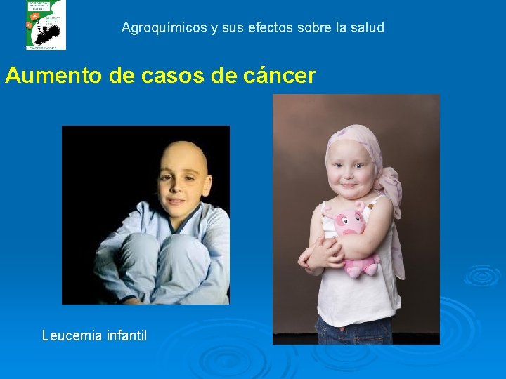 Agroquímicos y sus efectos sobre la salud Aumento de casos de cáncer Leucemia infantil