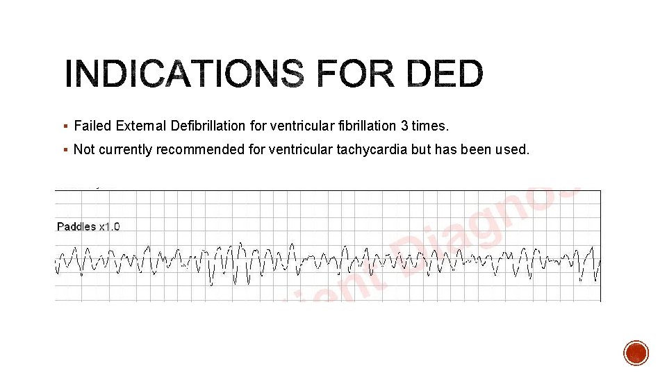 § Failed External Defibrillation for ventricular fibrillation 3 times. § Not currently recommended for