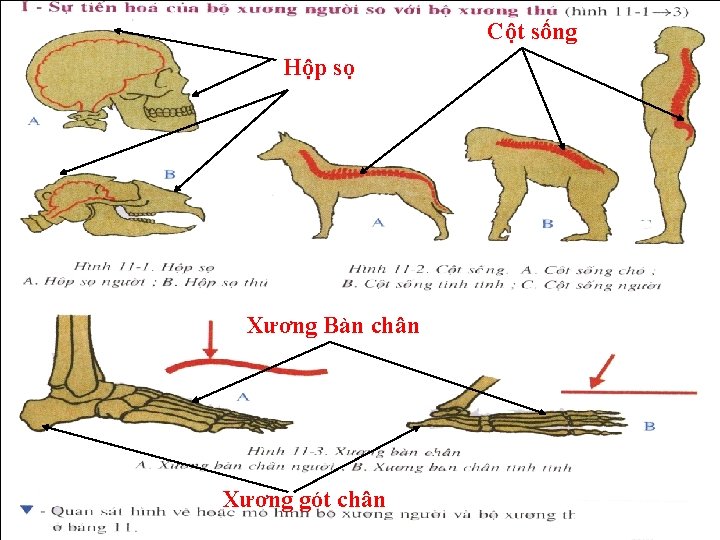 Cột sống Hộp sọ Xương Bàn chân Xương gót chân 