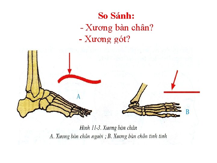 So Sánh: - Xương bàn chân? - Xương gót? 