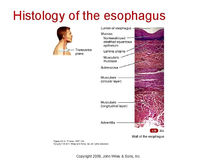 Histology of the esophagus Copyright 2009, John Wiley & Sons, Inc. 