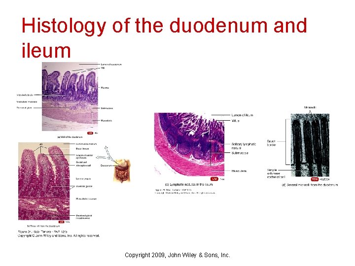 Histology of the duodenum and ileum Copyright 2009, John Wiley & Sons, Inc. 