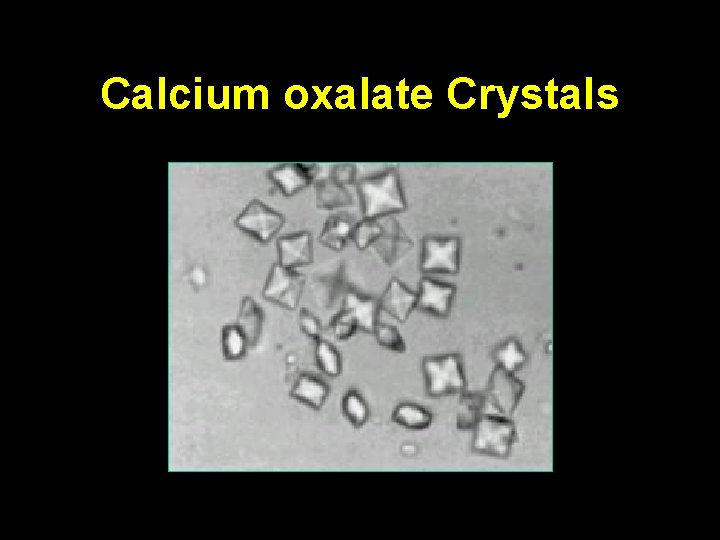 Calcium oxalate Crystals 