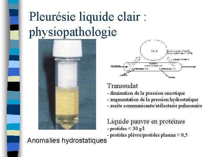 Pleurésie liquide clair : physiopathologie Transsudat - diminution de la pression oncotique - augmentation