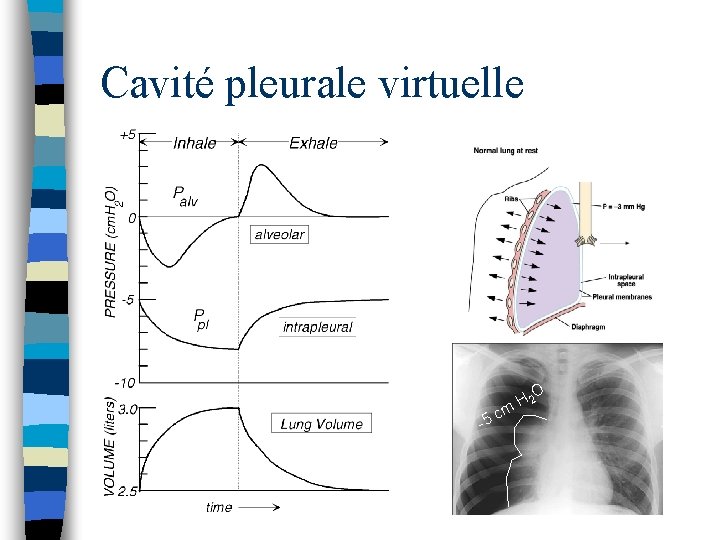 Cavité pleurale virtuelle m c -5 O H 2 