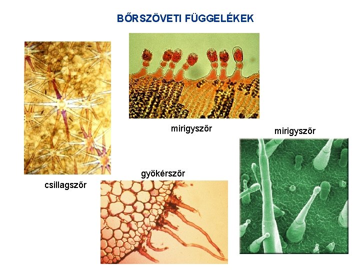 BŐRSZÖVETI FÜGGELÉKEK mirigyszőr gyökérszőr csillagszőr mirigyszőr 