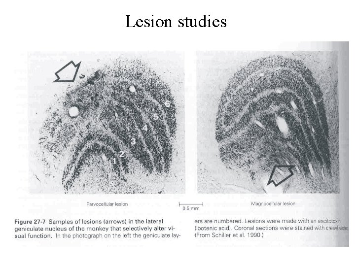 Lesion studies 