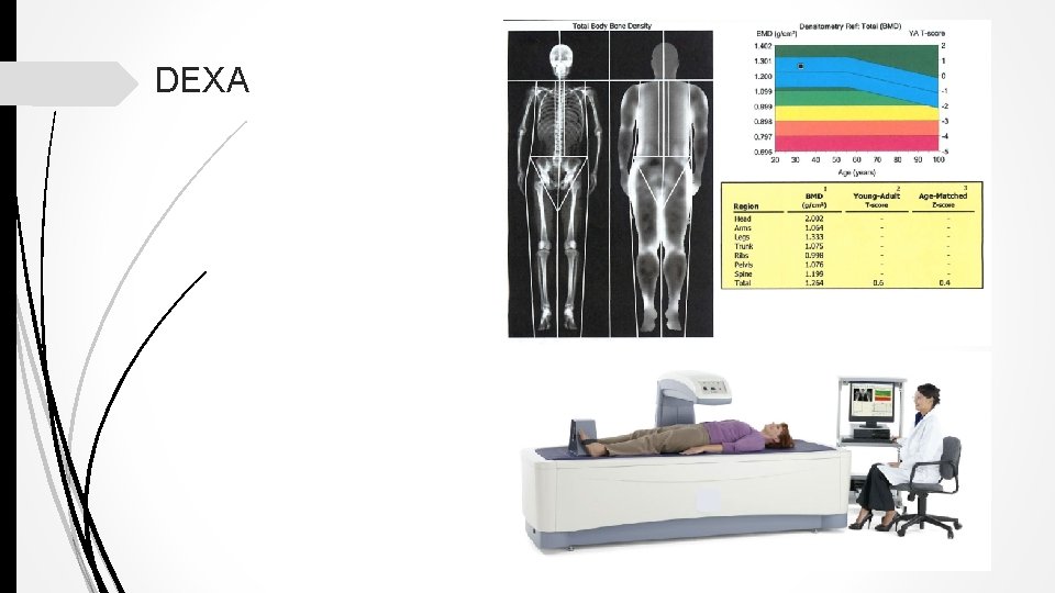 DEXA 