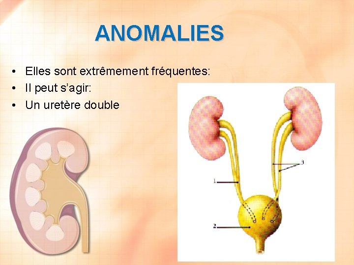 ANOMALIES • Elles sont extrêmement fréquentes: • Il peut s’agir: • Un uretère double