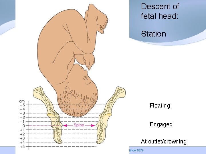 Descent of fetal head: Station Floating Engaged At outlet/crowning Descent of fetal head: Station Floating Engaged At outlet/crowning