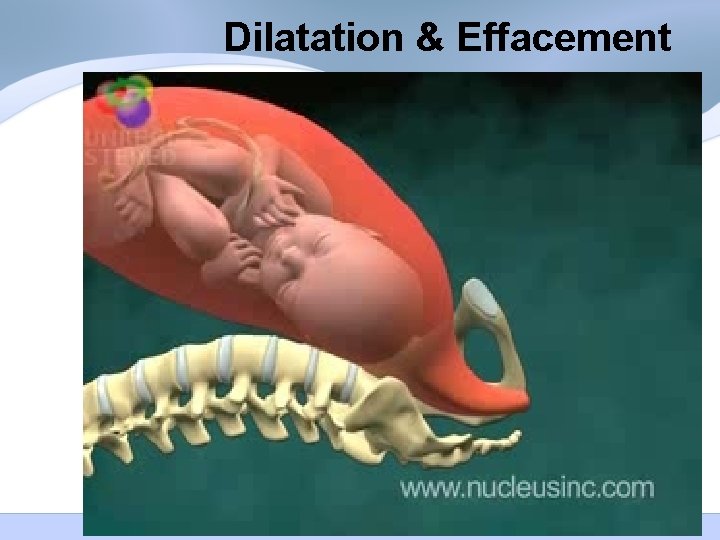 Dilatation & Effacement Dilatation & Effacement