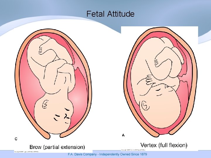 Fetal Attitude Fetal Attitude