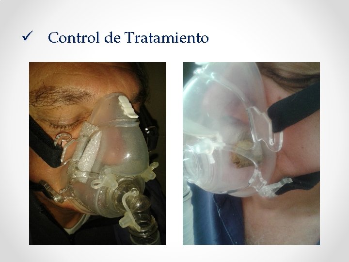 ü Control de Tratamiento 