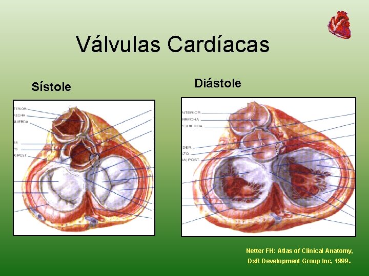 Válvulas Cardíacas Sístole Diástole Netter FH: Atlas of Clinical Anatomy, Dx. R Development Group