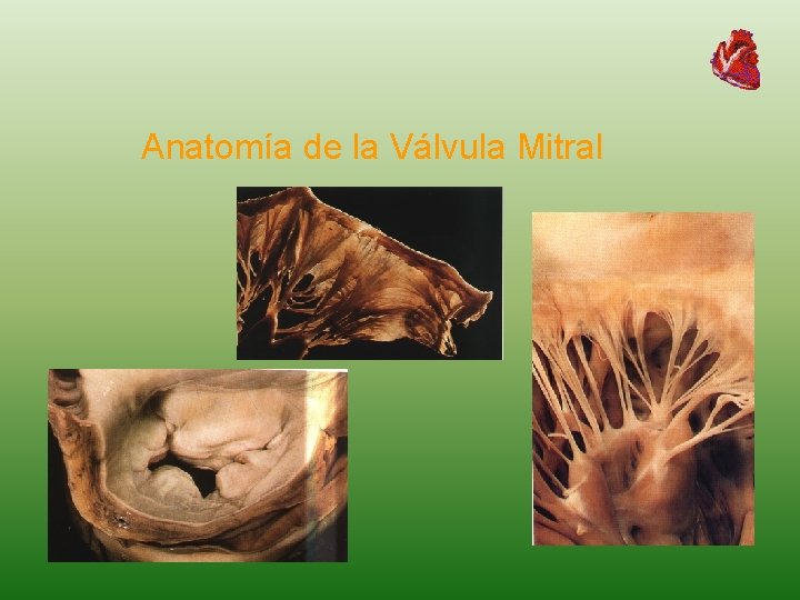 Anatomía de la Válvula Mitral 