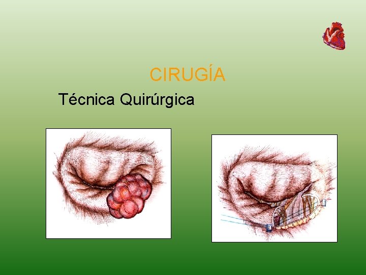 CIRUGÍA Técnica Quirúrgica 