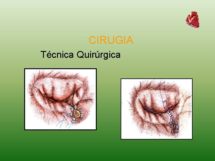 CIRUGIA Técnica Quirúrgica 