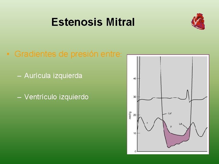 Estenosis Mitral • Gradientes de presión entre: – Aurícula izquierda – Ventrículo izquierdo 