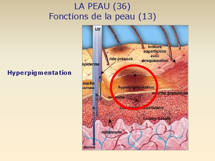 LA PEAU (36) Fonctions de la peau (13) Hyperpigmentation 