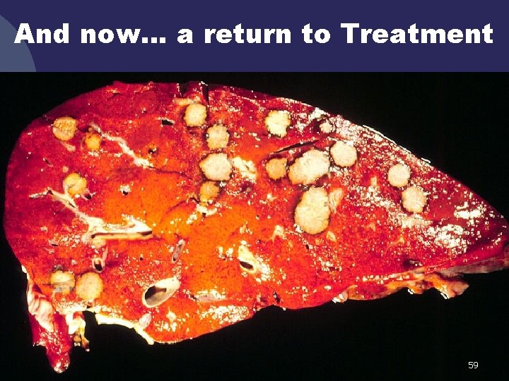 And now… a return to Treatment 59 