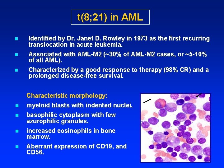 t(8; 21) in AML n Identified by Dr. Janet D. Rowley in 1973 as