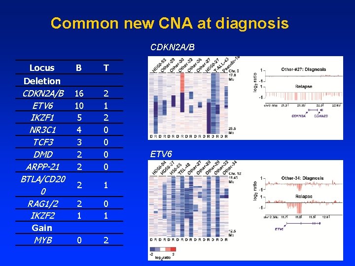 Common new CNA at diagnosis CDKN 2 A/B Locus Deletion B T CDKN 2