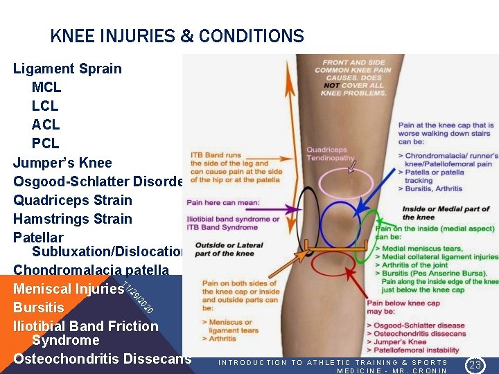 KNEE INJURIES & CONDITIONS 20 20 9/ /2 11 Ligament Sprain MCL LCL ACL