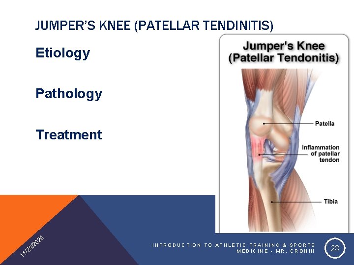 JUMPER’S KNEE (PATELLAR TENDINITIS) Etiology Pathology Treatment 20 1 0 /2 9 2 1/