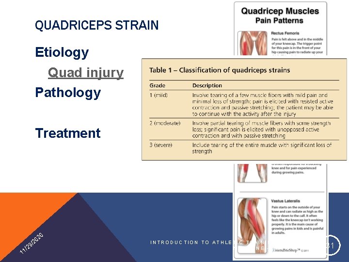 QUADRICEPS STRAIN Etiology Quad injury Pathology Treatment 20 1 0 /2 9 2 1/