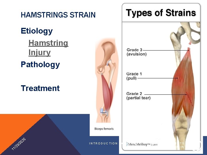 HAMSTRINGS STRAIN Etiology Hamstring Injury Pathology Treatment 20 1 0 /2 9 2 1/