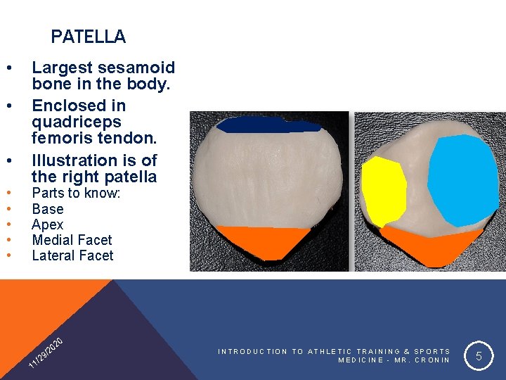 PATELLA • • Largest sesamoid bone in the body. Enclosed in quadriceps femoris tendon.