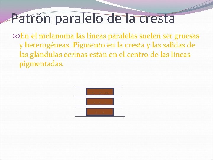 Patrón paralelo de la cresta En el melanoma las líneas paralelas suelen ser gruesas