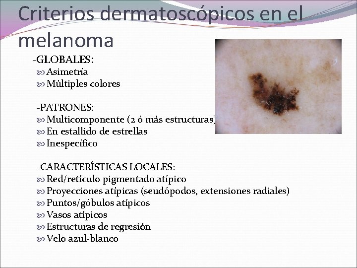 Criterios dermatoscópicos en el melanoma -GLOBALES: Asimetría Múltiples colores -PATRONES: Multicomponente (2 ó más