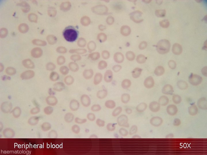 Peripheral blood 50 X 