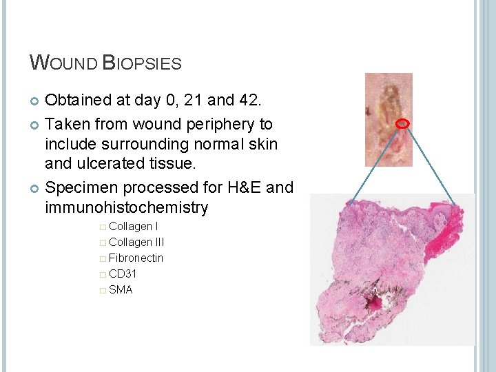 WOUND BIOPSIES Obtained at day 0, 21 and 42. Taken from wound periphery to