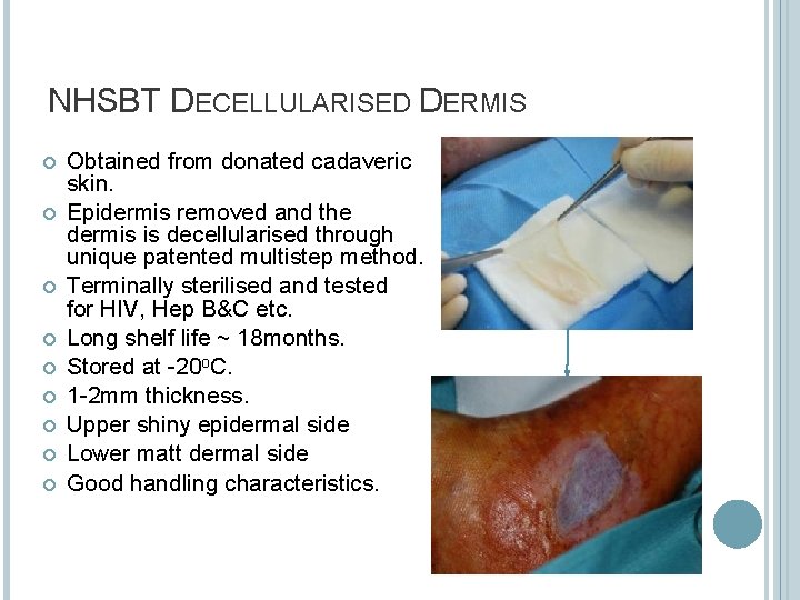 NHSBT DECELLULARISED DERMIS Obtained from donated cadaveric skin. Epidermis removed and the dermis is