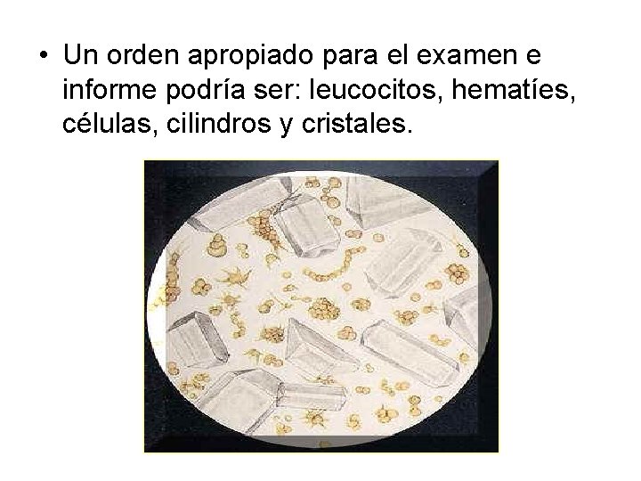  • Un orden apropiado para el examen e informe podría ser: leucocitos, hematíes,