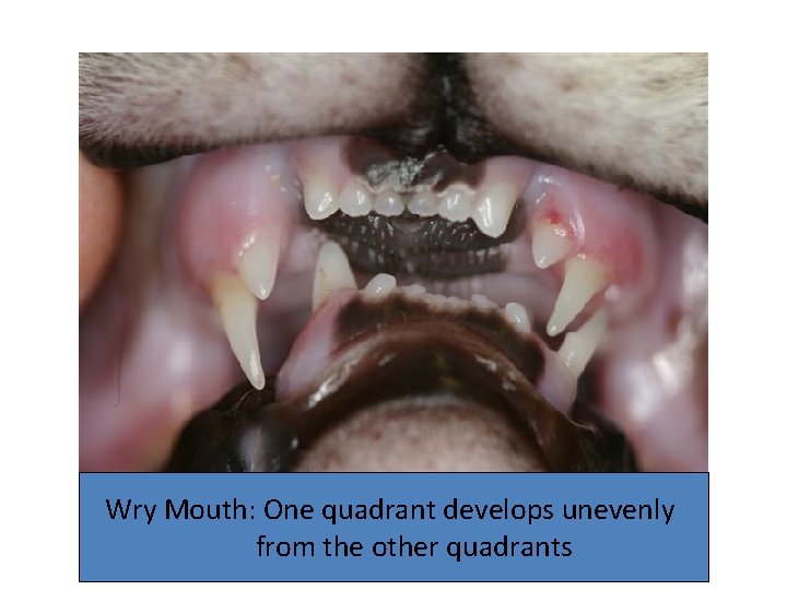 Wry Mouth: One quadrant develops unevenly from the other quadrants 