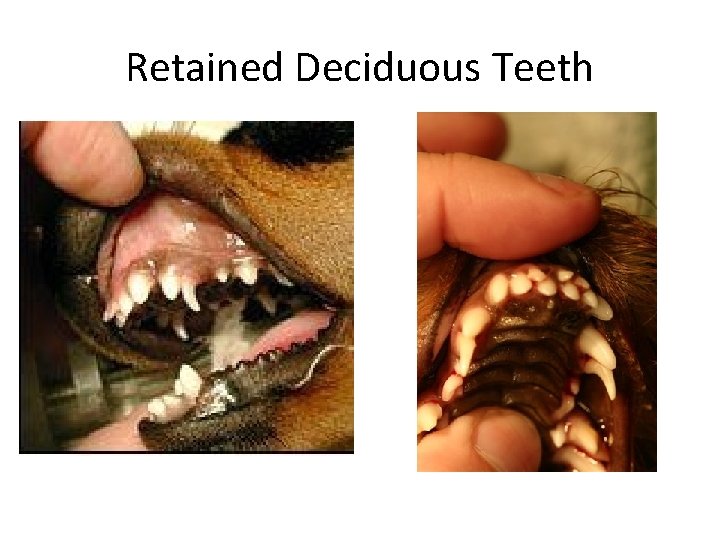 Retained Deciduous Teeth 