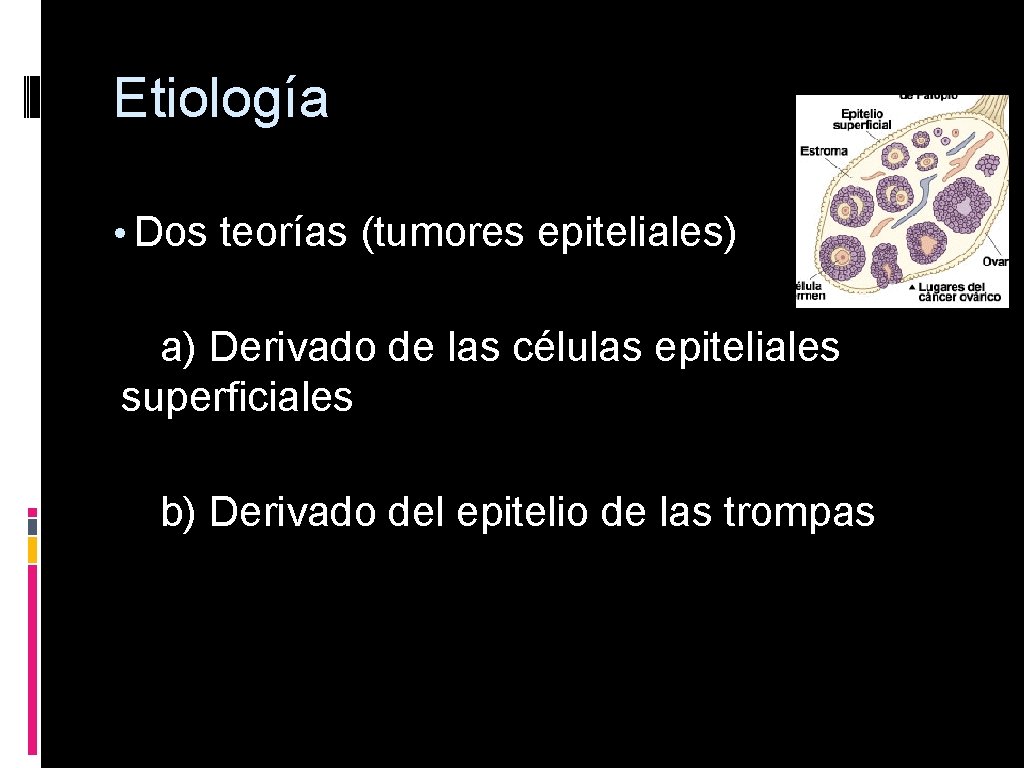 Etiología • Dos teorías (tumores epiteliales) a) Derivado de las células epiteliales superficiales b)