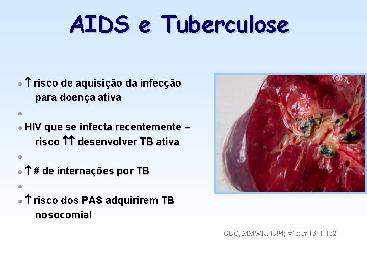 AIDS e Tuberculose risco de aquisição da infecção para doença ativa HIV que se