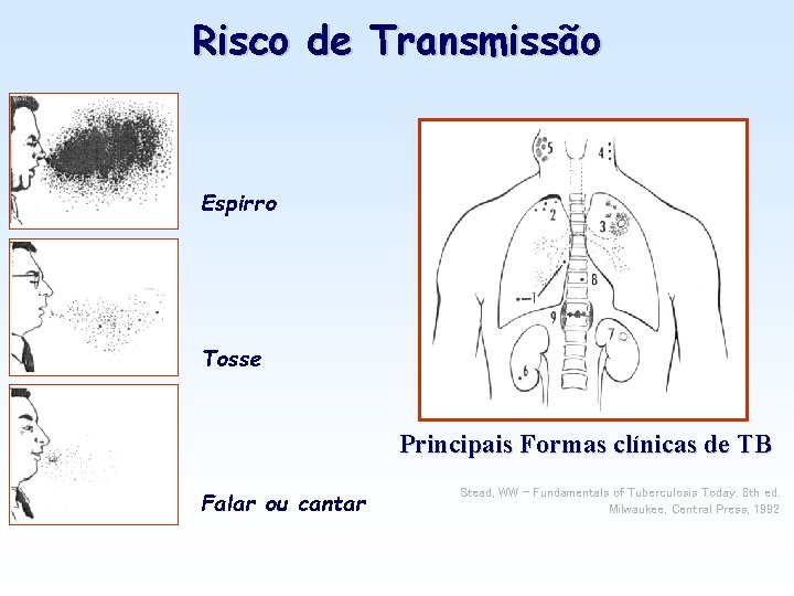 Risco de Transmissão Espirro Tosse Principais Formas clínicas de TB Falar ou cantar Stead,