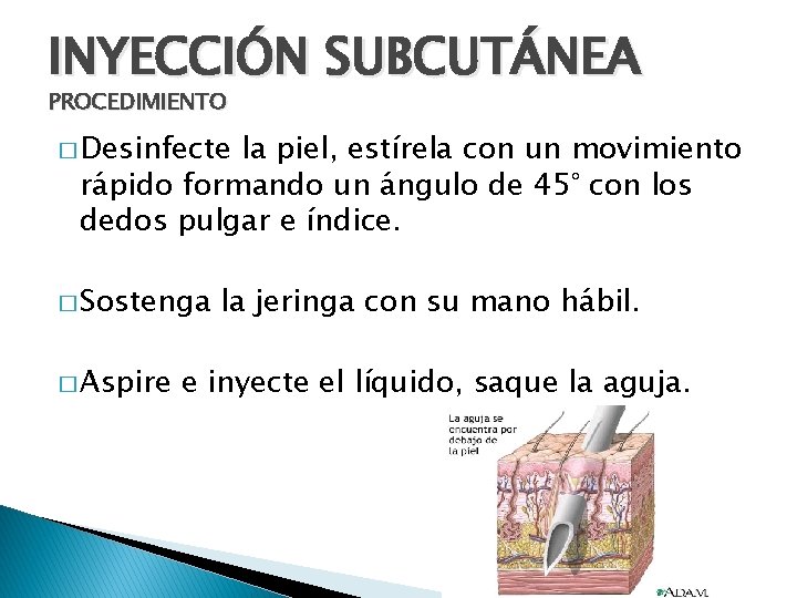 INYECCIÓN SUBCUTÁNEA PROCEDIMIENTO � Desinfecte la piel, estírela con un movimiento rápido formando un