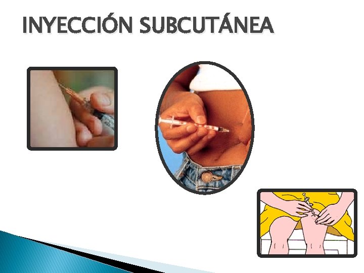 INYECCIÓN SUBCUTÁNEA INYECCIÓN SUBCUTÁNEA