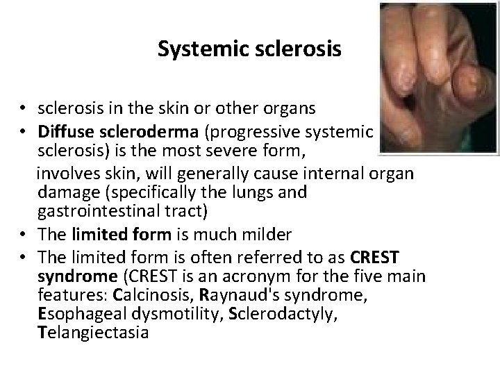 Systemic sclerosis • sclerosis in the skin or other organs • Diffuse scleroderma (progressive