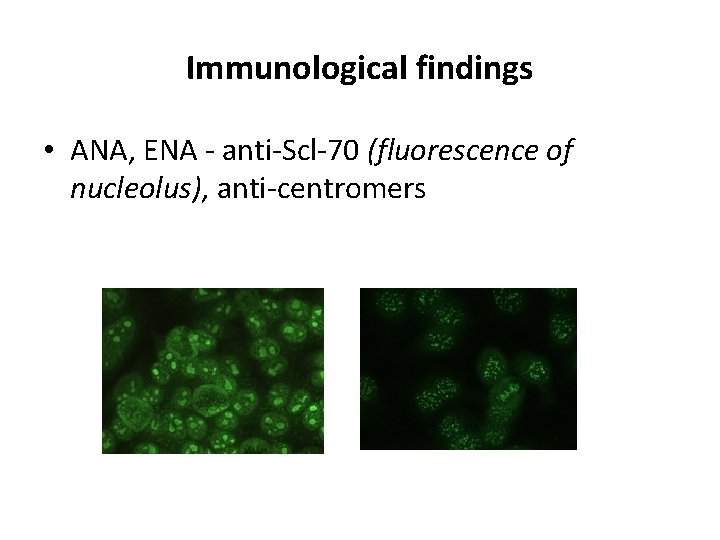 Immunological findings • ANA, ENA - anti-Scl-70 (fluorescence of nucleolus), anti-centromers 